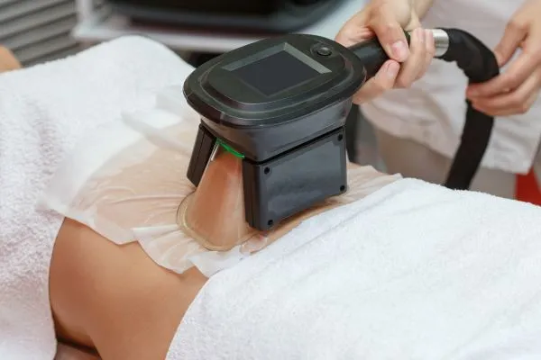 Image of person having fat freezing treatment to help weight gain Benson