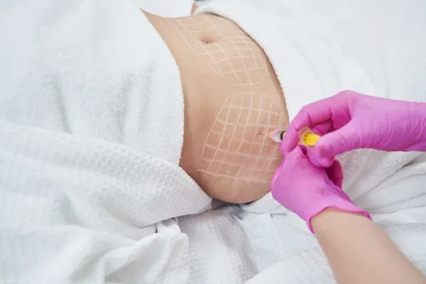 image of fat dissolving injections on love handles to help combat weight gain Benson