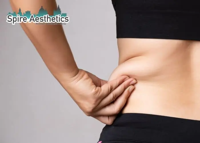 Image of woman pinching fat on their hips Benson. Fat Freezing treatment