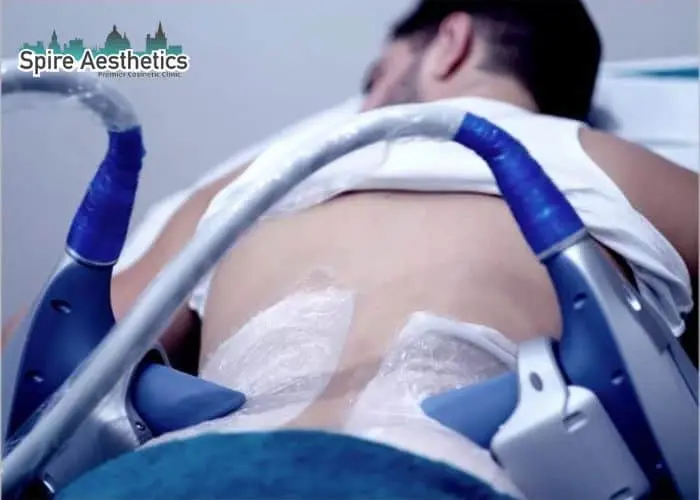 Man having fat freezing treatment done on love handles before a competitions Benson to create a sculpted look.